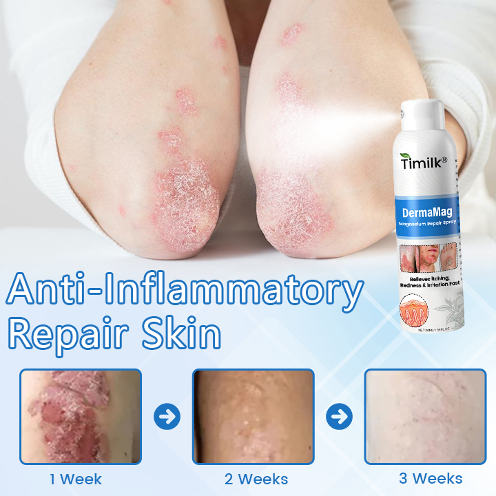 ✅ Official Store: Timilk® DermaMag Magnesium Repair Spray 🔥 FDA Certified (Clinically Proven Relief for Psoriasis, Eczema, and Chronic Skin Irritation 🌿)