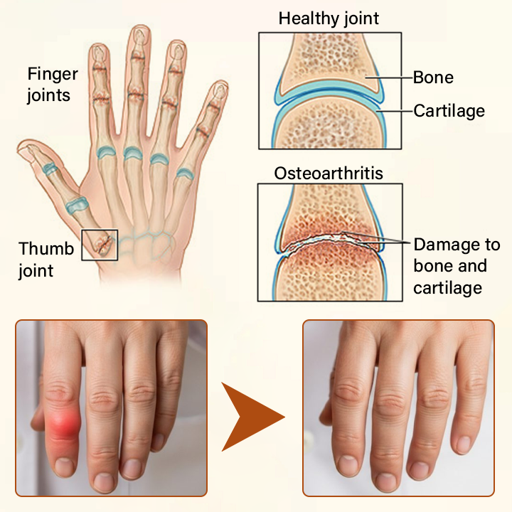 Timilk® VenomEase Joint Cream
