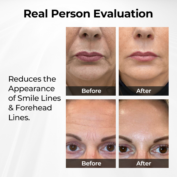 Biancat® TightShift Precision Contour & Firming Serum