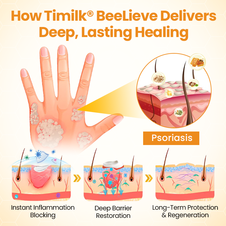 TimilkĀ®BeeLieve Psoriasis Skin Care š„