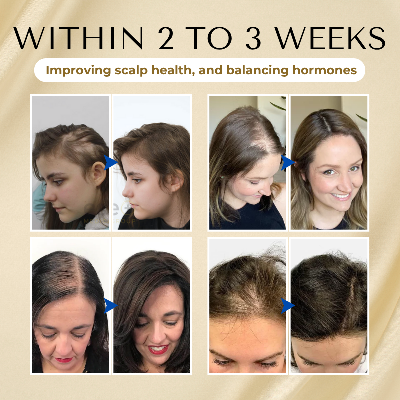 Timilk® VitaStrand Biotin Hair Growth Spray