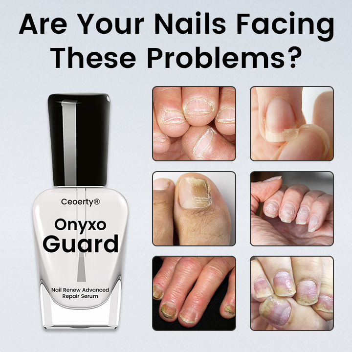 Ceoerty® OnyxoGuard Nail Renew Advanced Repair Serum