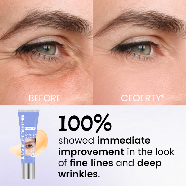 Ceoerty® InstaLift Eye Tightener 🔥