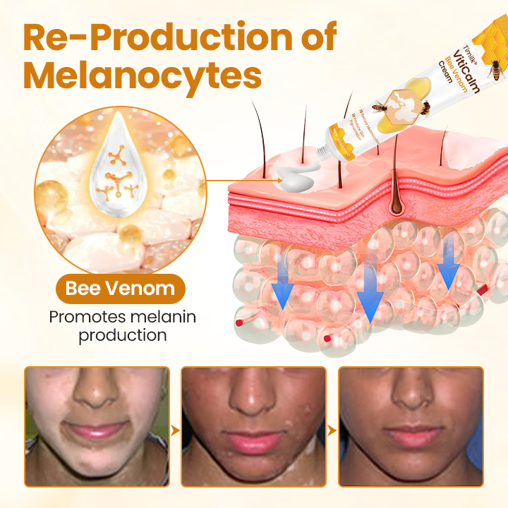 Timilk® VitiCalm Bee Venom Cream