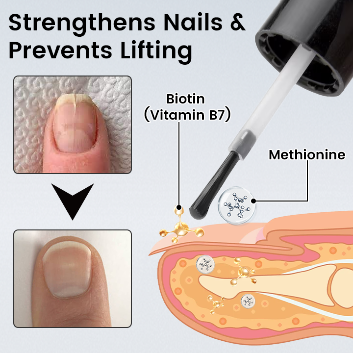 Ceoerty® OnyxoGuard Nail Renew Advanced Repair Serum