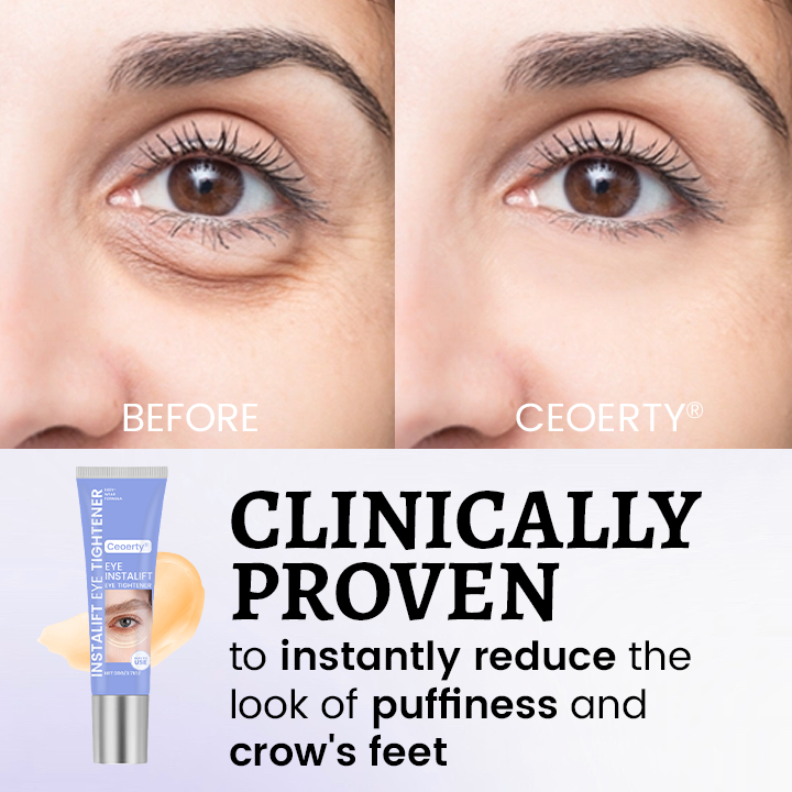 Ceoerty® InstaLift Eye Tightener 🔥