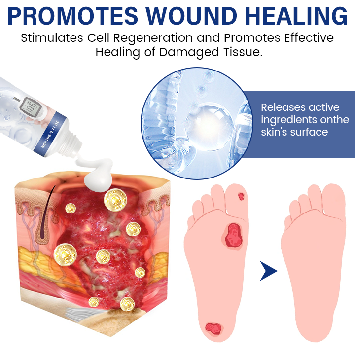 Timilk® SugarRelief Diabetic Treatment Cream