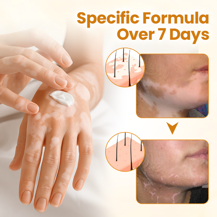 Timilk® VitiCalm Bee Venom Cream