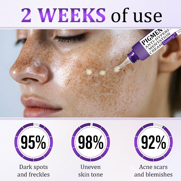 Ceoerty® PigmentaX ProFade Anti-Hyperpigmentation Cream