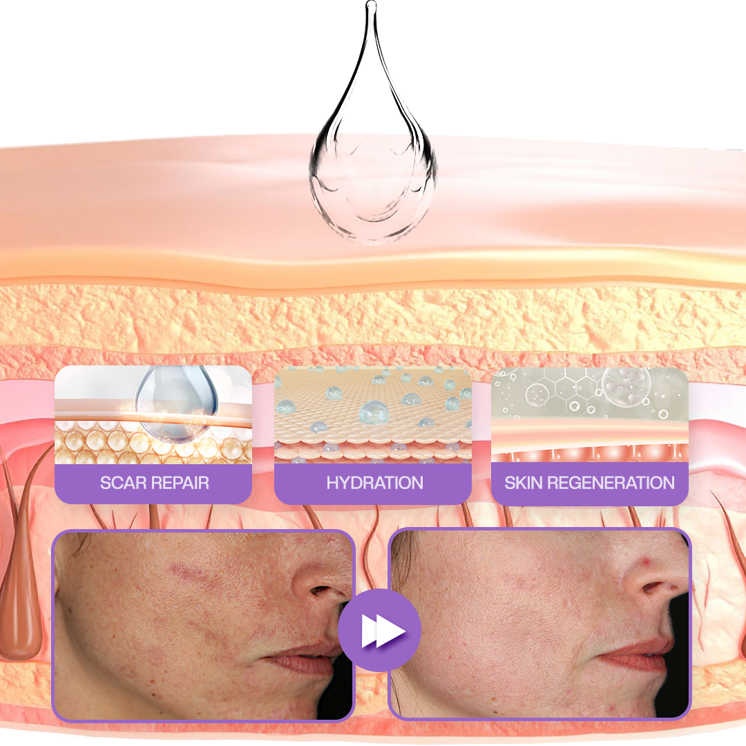 Timilk® RevivaDerma Face & Body Scar Gel