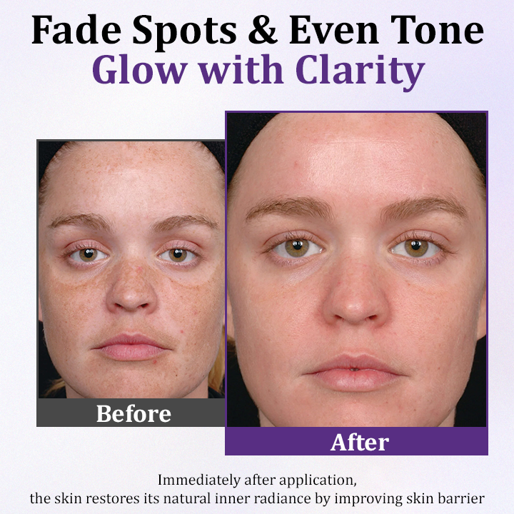 Ceoerty® PigmentaX ProFade Anti-Hyperpigmentation Cream