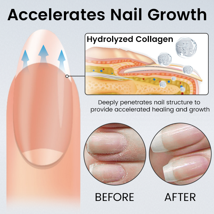 Ceoerty® OnyxoGuard Nail Renew Advanced Repair Serum