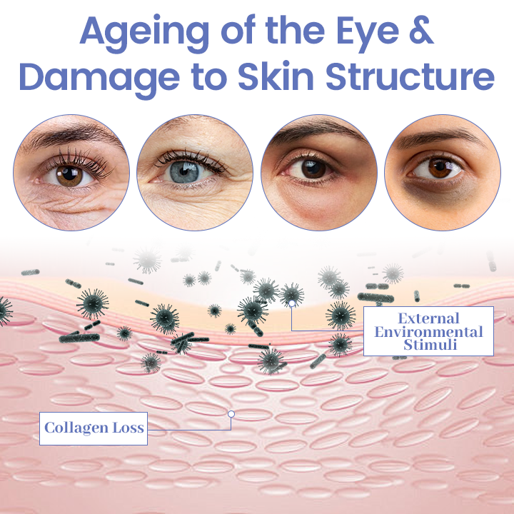 Ceoerty® InstaLift Eye Tightener 🔥