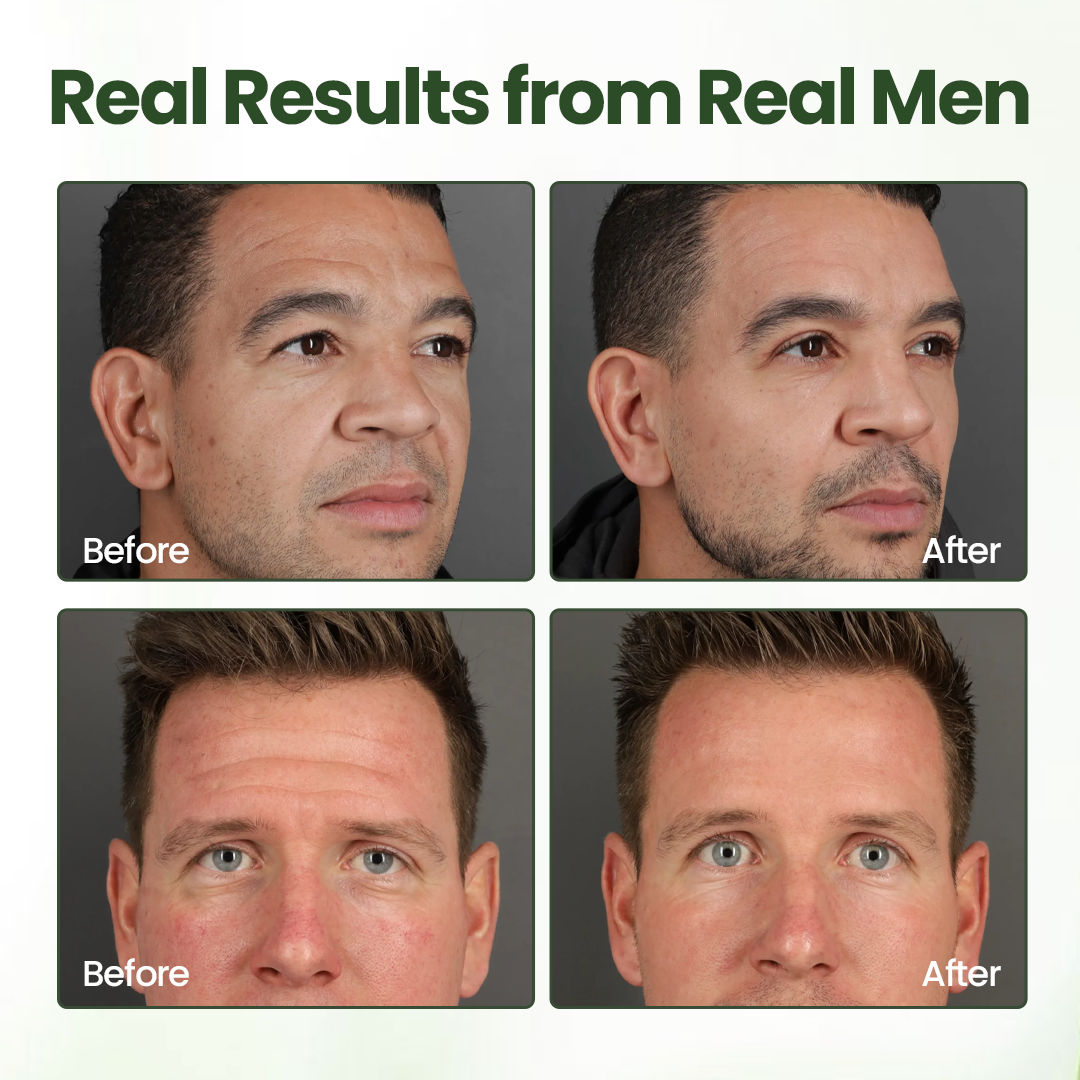 Biancat® FortiTallow Anti-Wrinkle Balm