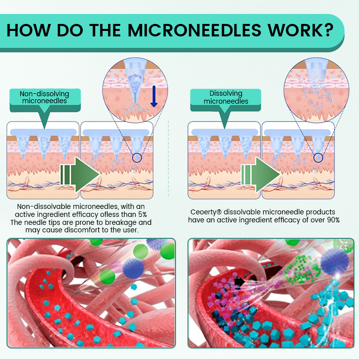 Ceoerty® Slimura GLP-1 Nano Microneedle Patch
