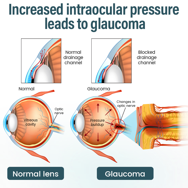 Timilk® OptiFusion Nano Eye Drops Serum 🔥