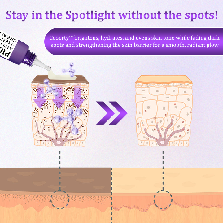 Ceoerty® PigmentaX ProFade Anti-Hyperpigmentation Cream