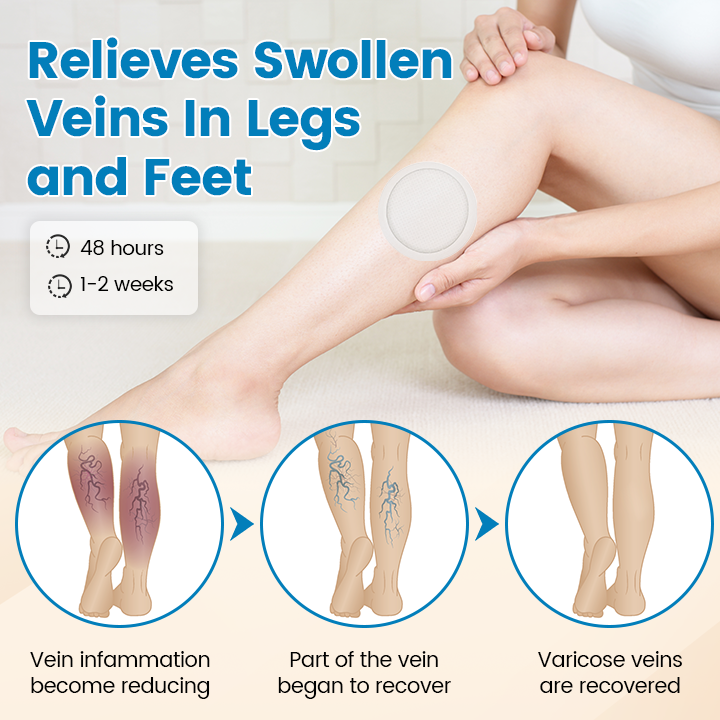 Timilk® VeinGuard Microneedle Patch 🔥 ( Advanced Circulation Support for Varicose & Spider Veins )