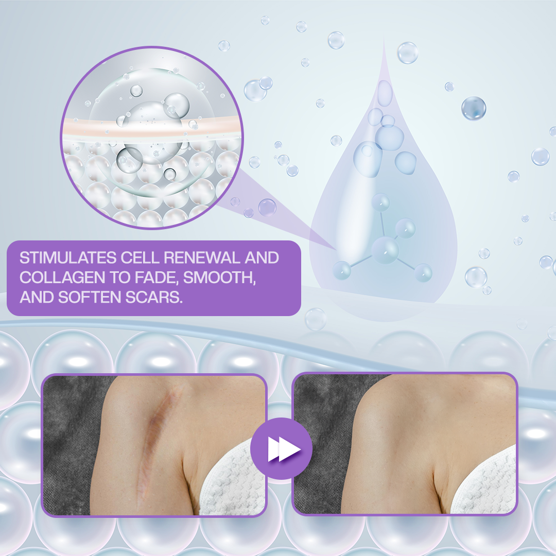 Timilk® RevivaDerma Face & Body Scar Gel