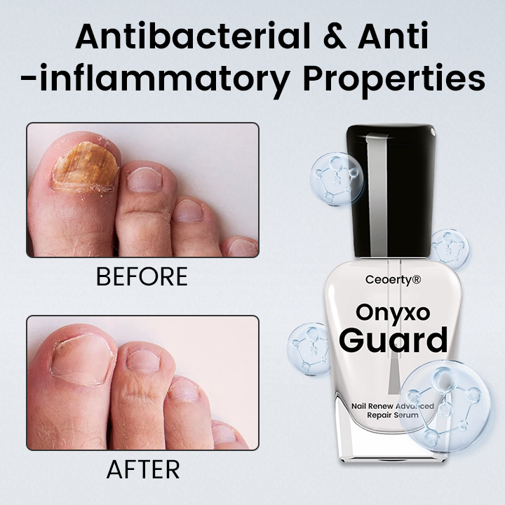Ceoerty® OnyxoGuard Nail Renew Advanced Repair Serum