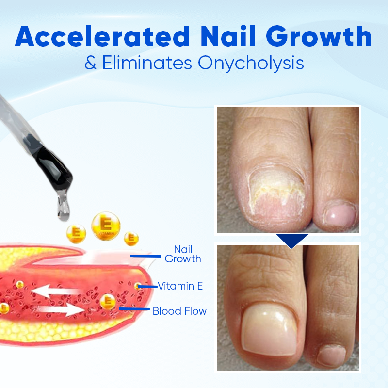 Biancat® OnyxoGuard Nail Growth and Repair Serum