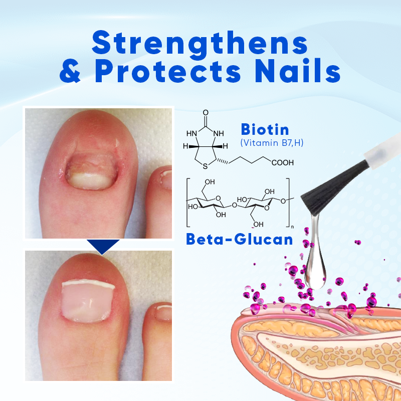 Biancat® OnyxoGuard Nail Growth and Repair Serum