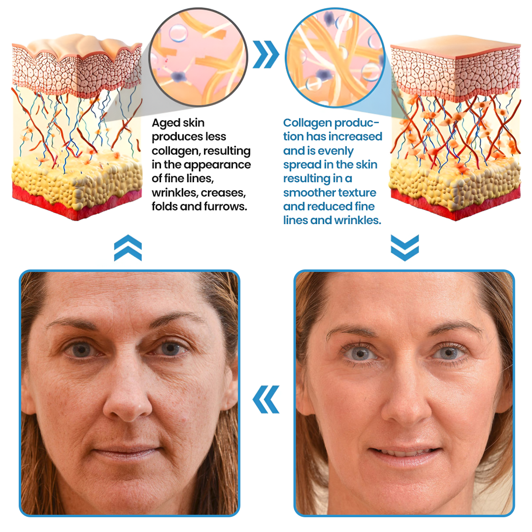 Biancat® Collagen Peptide Serum🇺🇸