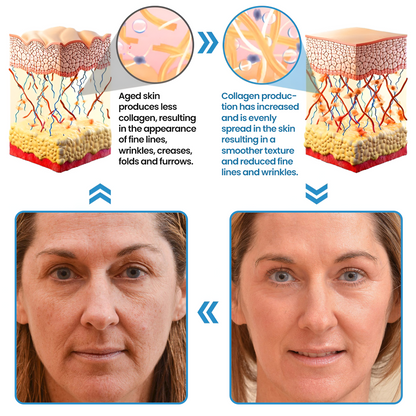 Biancat® Collagen Peptide Serum🇺🇸