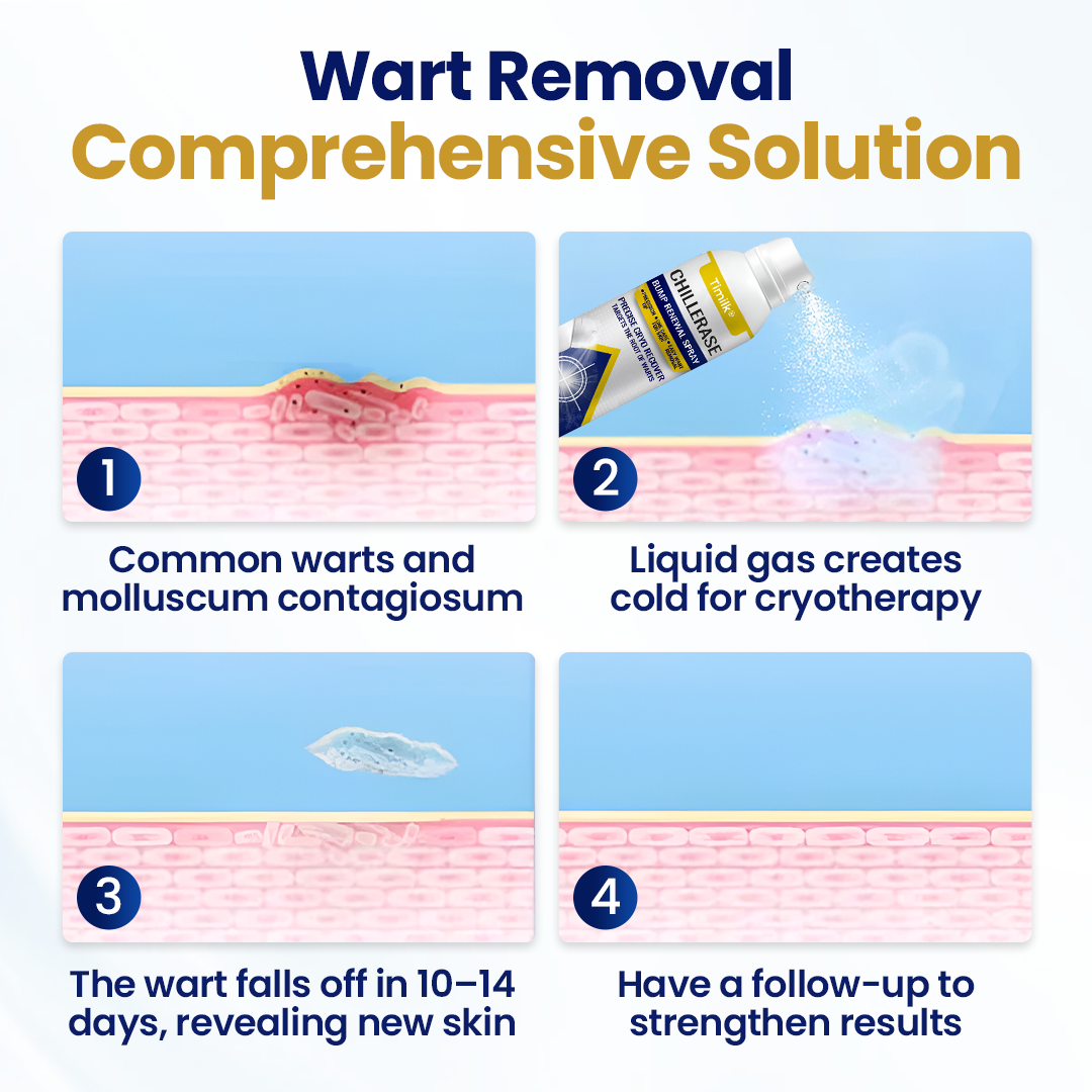 Timilk® ChillErase Bump Renewal Spray🔥