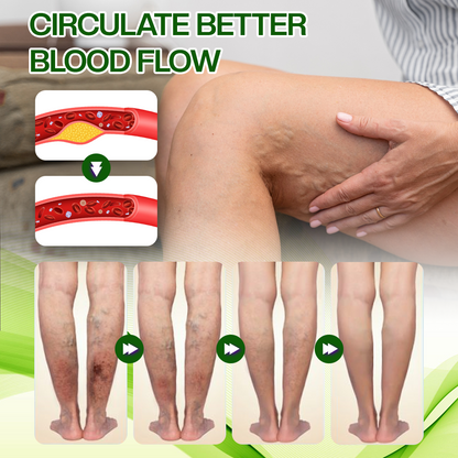 Timilk® SwellRelief Horse Chestnut Edema Cream