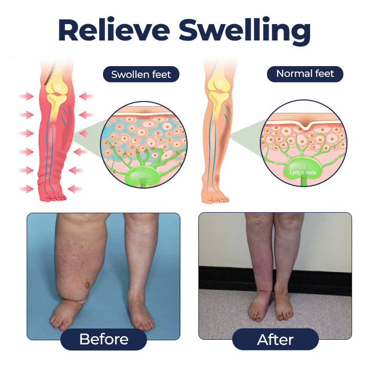 Timilk® SwellRelief Circulation Support Cream