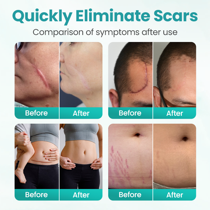 Timilk® EliteAloe ScarSolve Spray 🔥