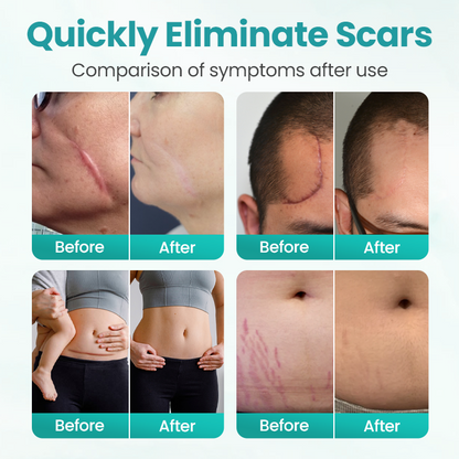 Timilk® EliteAloe ScarSolve Spray 🔥