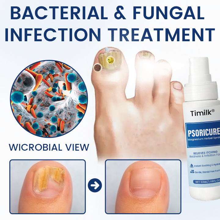 Timilk® PsoriCure Magnesium Herbal Spray