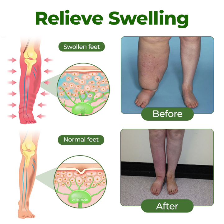 Timilk® Professional Leg Circulation Cream