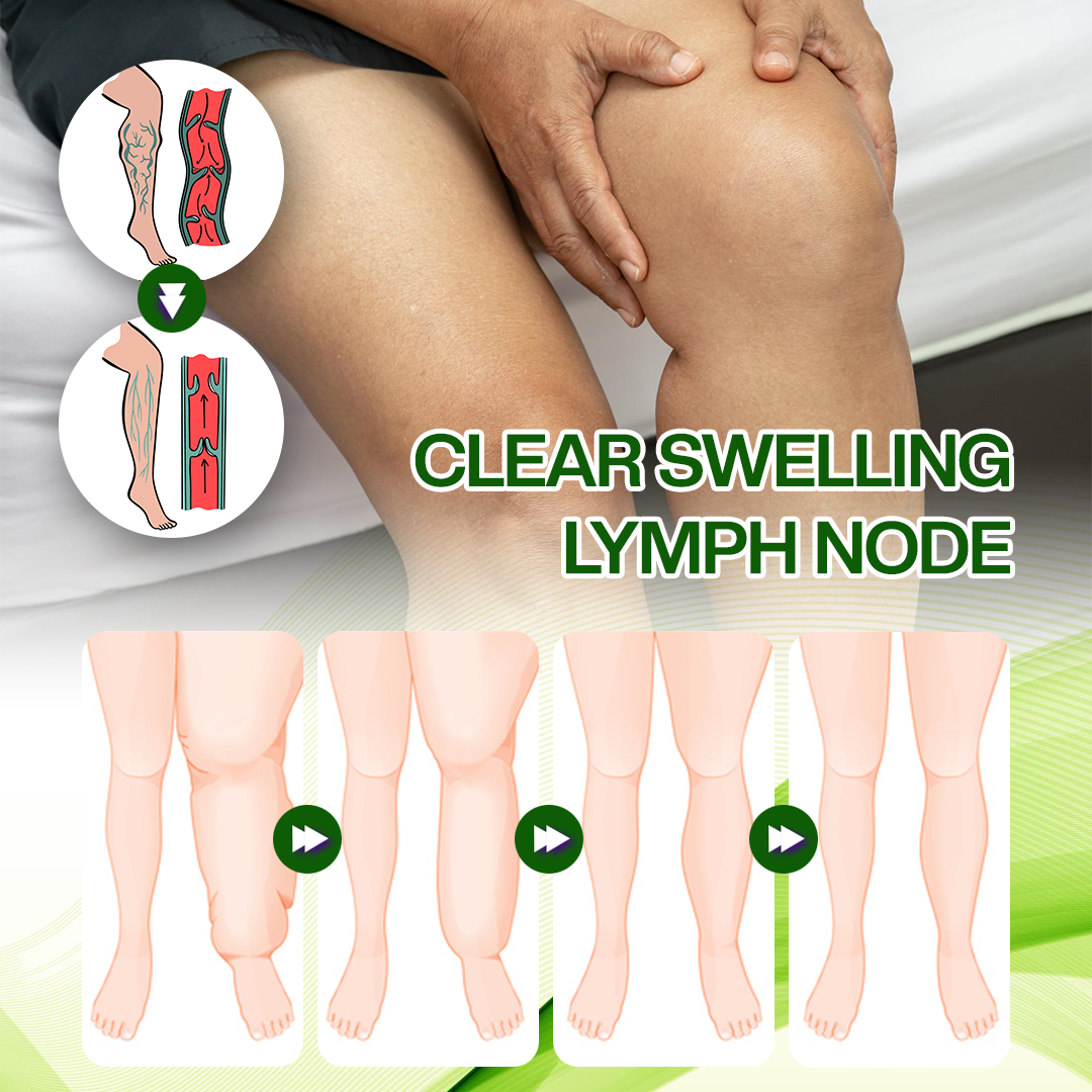 Timilk® SwellRelief Horse Chestnut Edema Cream