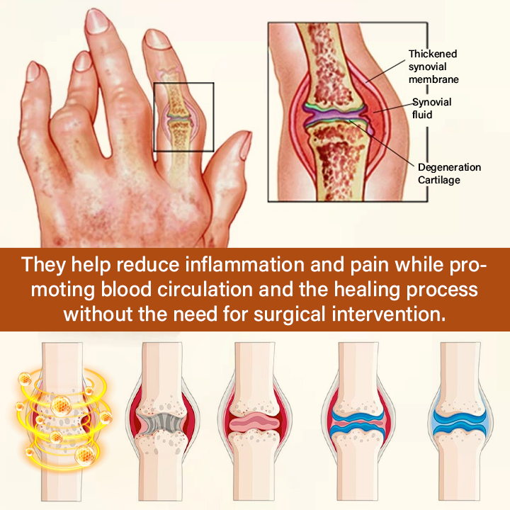Timilk® VenomEase Joint Cream