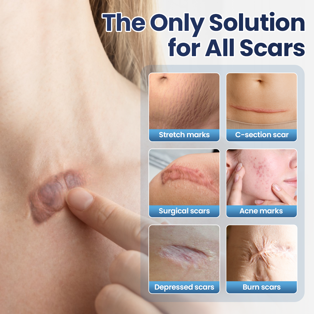 Biancat® DermaFix Texture Repair Gel