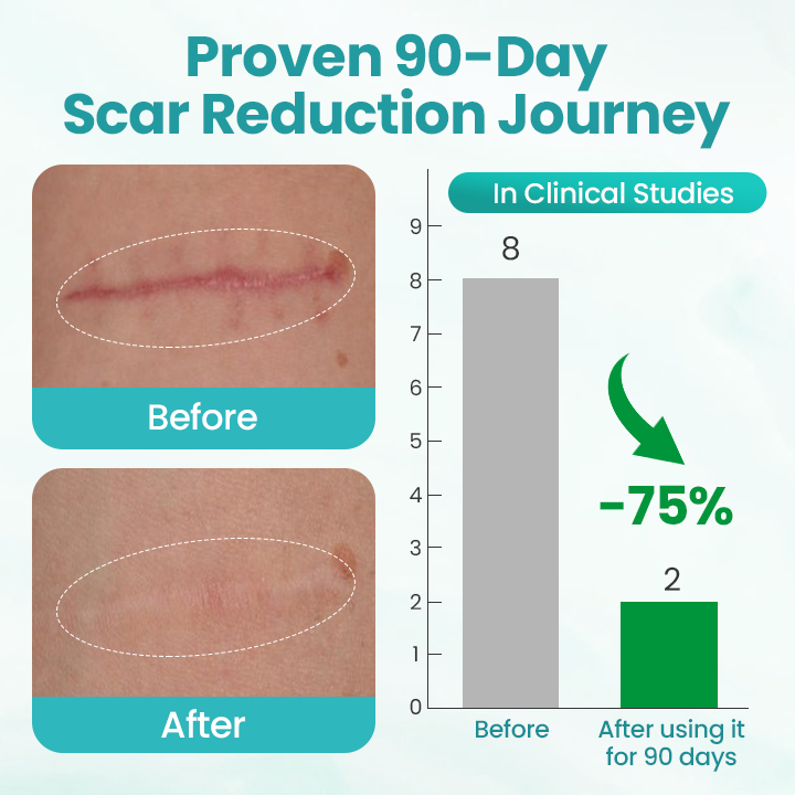 Timilk® EliteAloe ScarSolve Spray 🔥