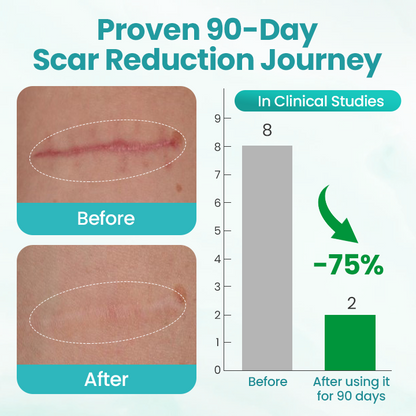 Timilk® EliteAloe ScarSolve Spray 🔥