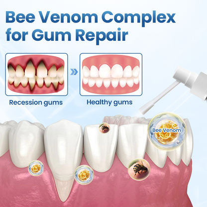 Timilk® GumRelief Natural Spray🔥