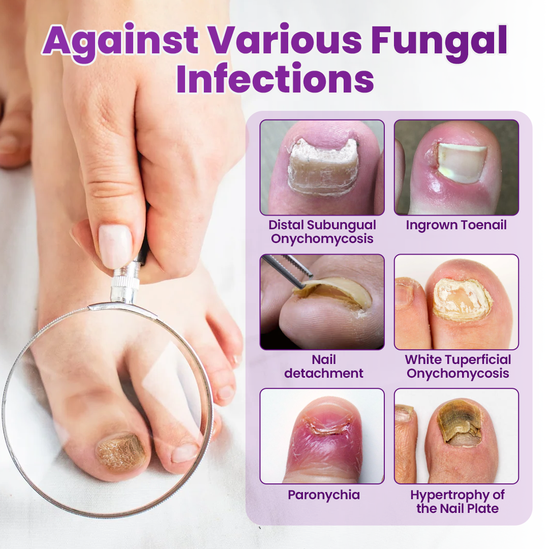 Timilk® AeroFilm Foot Defense Mist