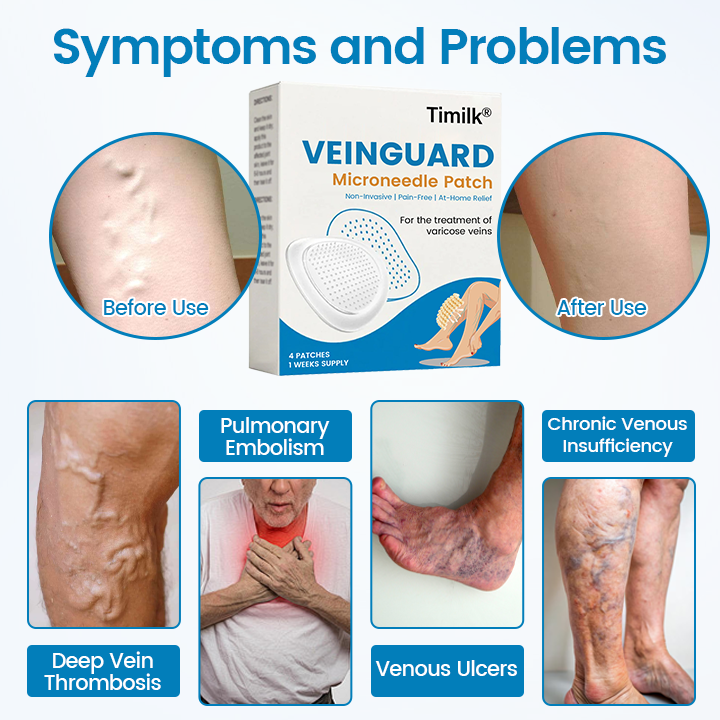 Timilk® VeinGuard Microneedle Patch 🔥 ( Advanced Circulation Support for Varicose & Spider Veins )