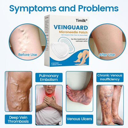 Timilk® VeinGuard Microneedle Patch 🔥 ( Advanced Circulation Support for Varicose & Spider Veins )