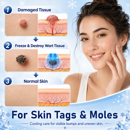 Ceoerty® CryoClear Pro Bump Renewal Spray