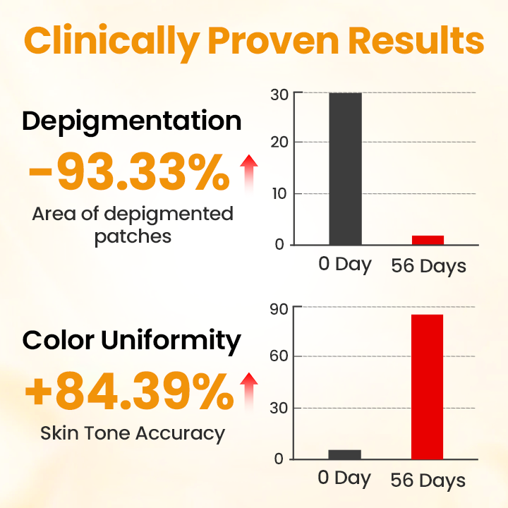 Timilk® VitiGone Rapid Spray — 2–3 Week Repigmentation with OTDS 😃