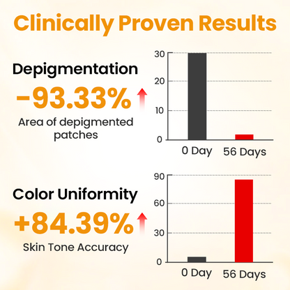 Timilk® VitiGone Rapid Spray — 2–3 Week Repigmentation with OTDS 😃