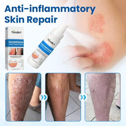 Timilk® Magnesium Herbal Treatment Spray