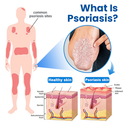 Timilk® Magnesium Herbal Treatment Spray