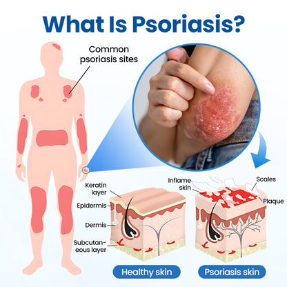 Timilk® PCA Magnesium Deep Repair Spray